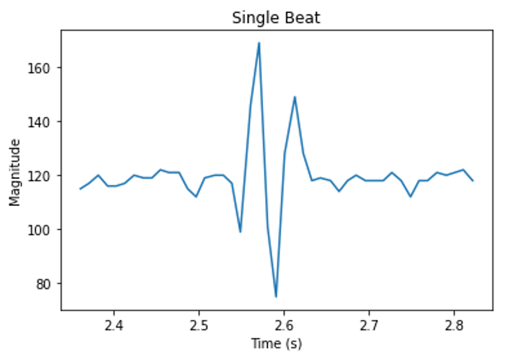 ecg